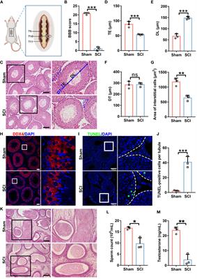 Nitric oxide-induced lipophagic defects contribute to testosterone deficiency in rats with spinal cord injury